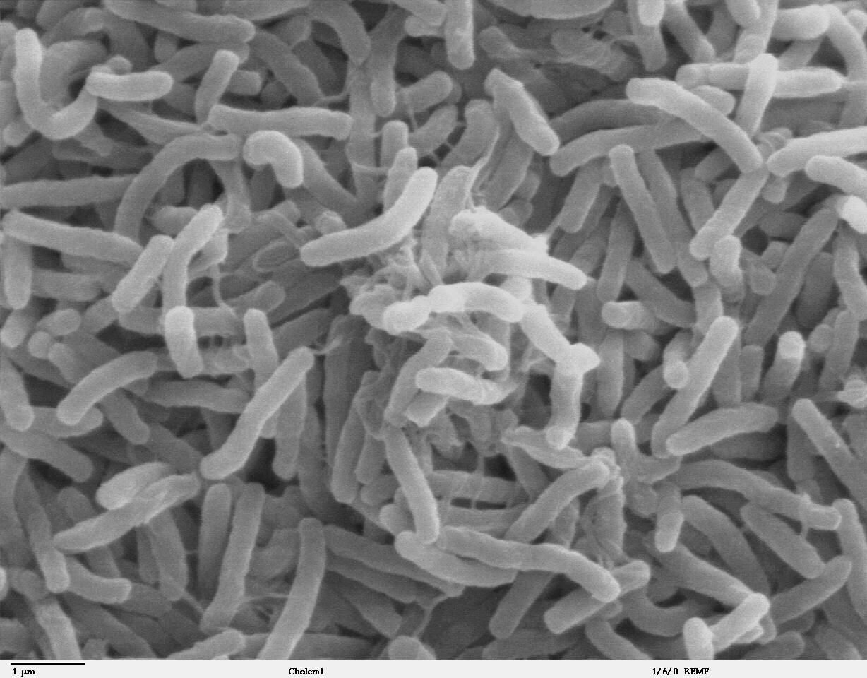 bacteria que causa cólera