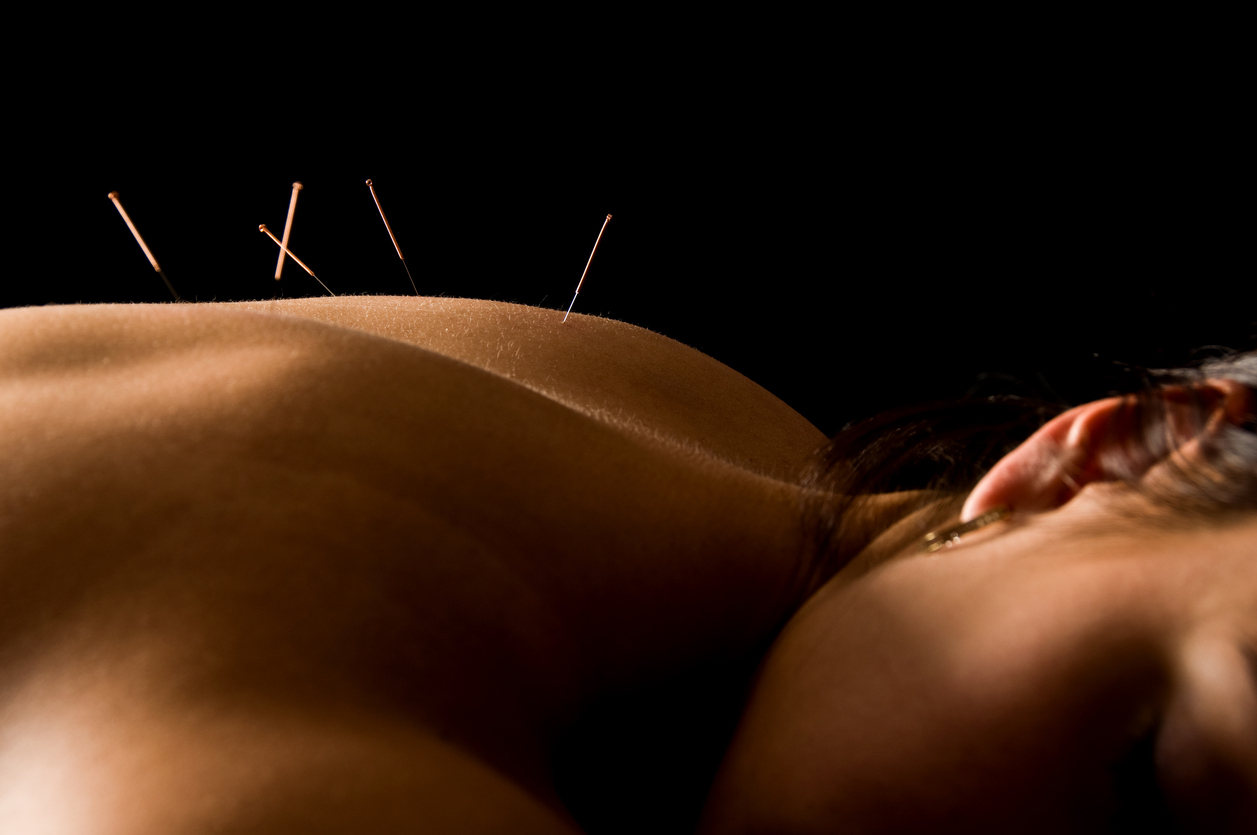 acupuntura es pseudociendia con fines curativos