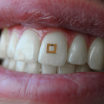 Sensor diente