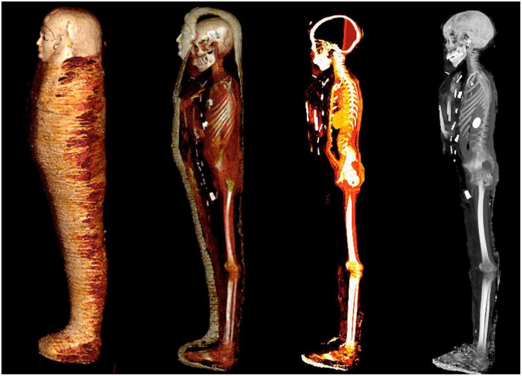 Tomografías computarizadas momia egipto