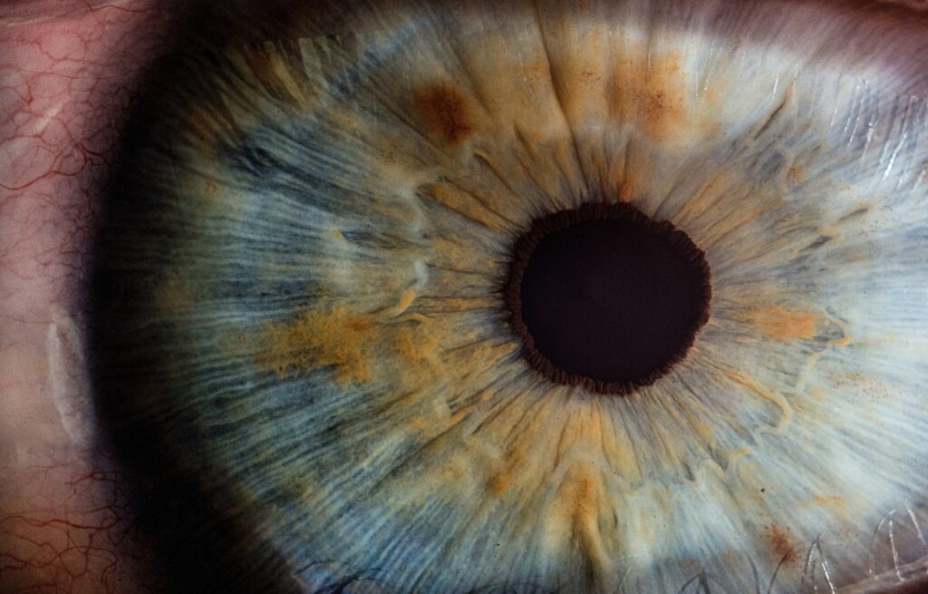 ¿Qué determina el color de los ojos?