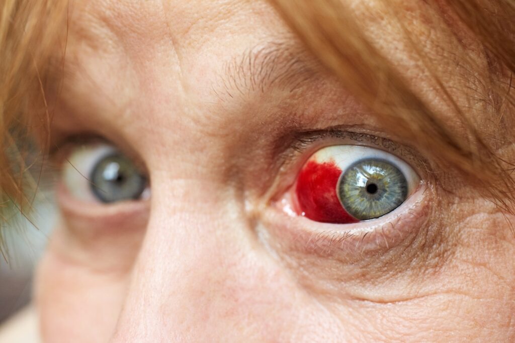 ¿Cuáles son los riesgos de la operación de cambio de color de ojos?